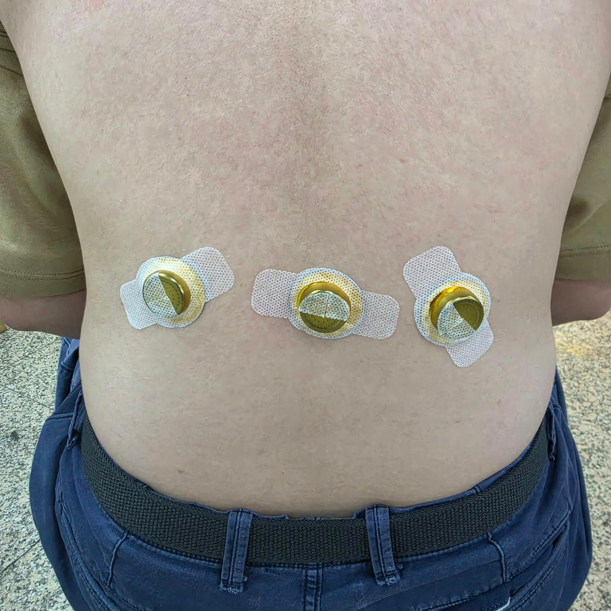 Jianzhitang Smokeless Moxibustion Acupoint Patch 12 Patches | Precise Acupoint Coverage | Unblocks Meridians